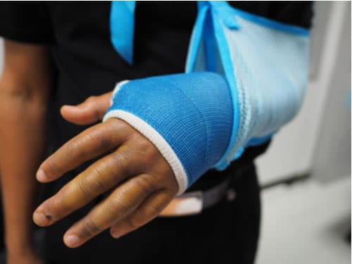 Atlanta personal injury lawyer concept broken arm in cast