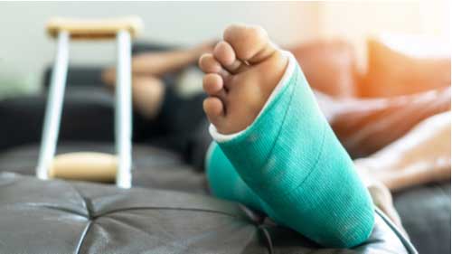 Man with broken leg concept of Smyrna personal injury lawyer